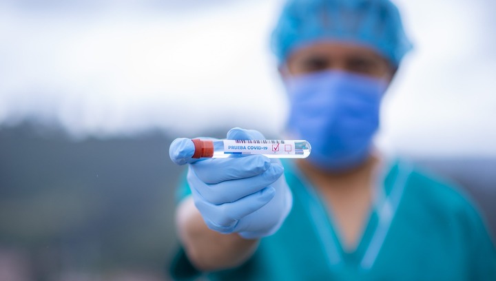 В Марий Эл за сутки выявлен 41 новый случай коронавируса