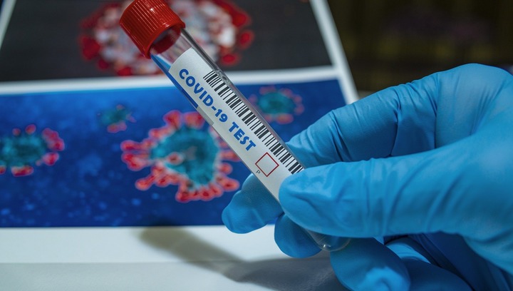 В Марий Эл выявлено 38 новых случаев коронавируса