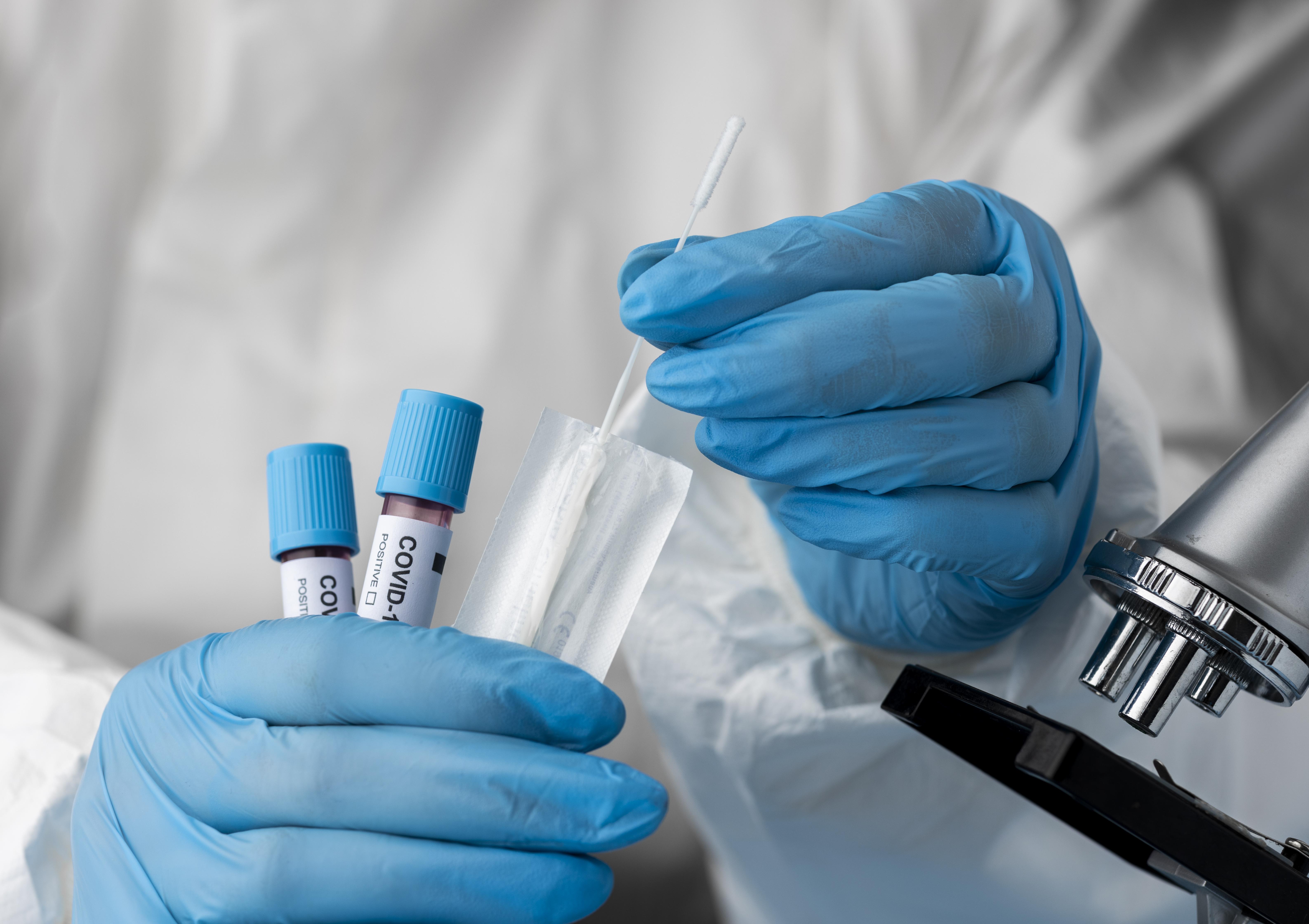 За прошедшие сутки в Марий Эл выявлено 7 случаев заболевания коронавирусом